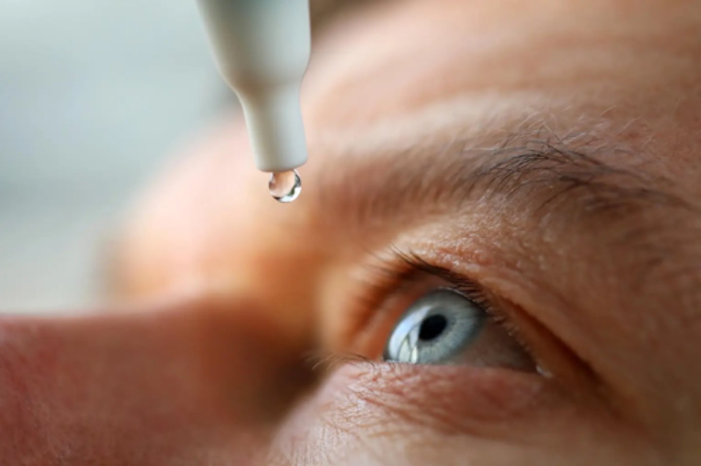 <p>What indication for corneal transplant is seen here?</p>
