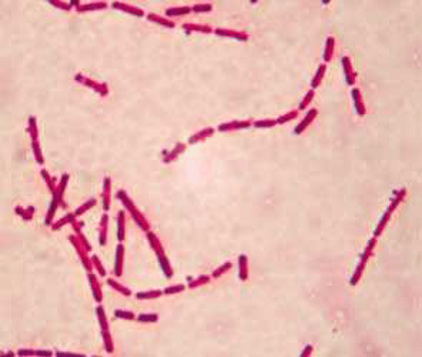 <p>Long chain or filaments of bacteria</p>