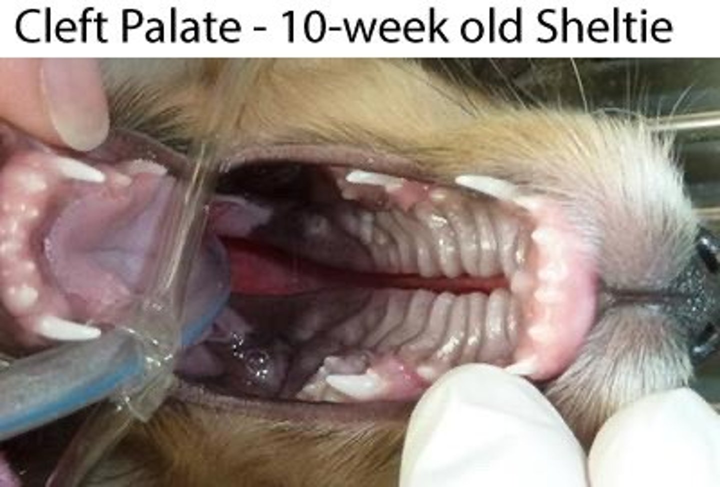 <p>Failure of the two sides of the hard or soft palate to fuse correctly is called:</p>