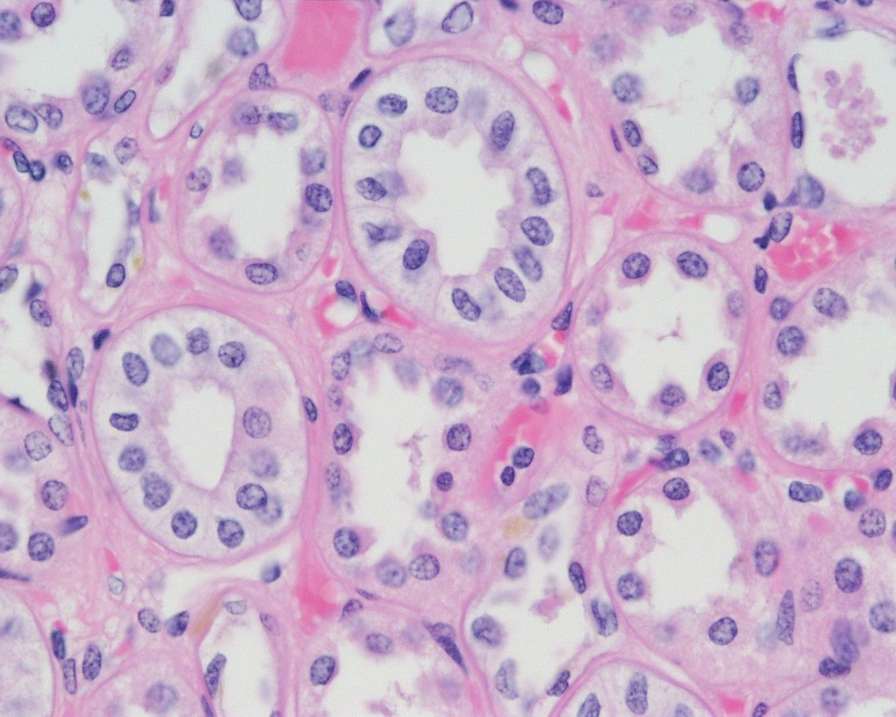 <p>the nucleus of this type of epithelial cell appears round and is generally located near the center of the cell</p>