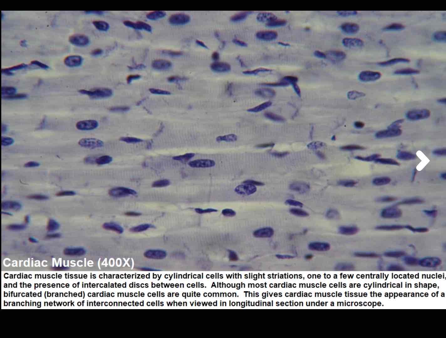 <p>Can you identify this muscle, provide a function, location and characteristic </p>