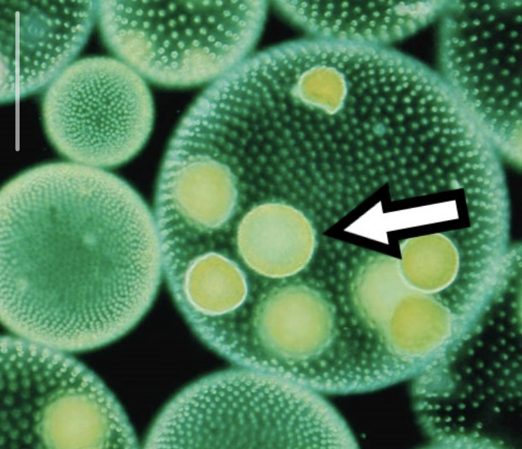 <p>Identify the structure indicated by the arrow</p>