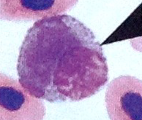 <p>What WBC is this?</p>