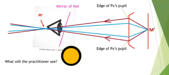<p>pupil will be filled </p><p>close to the retinoscope </p><p></p>