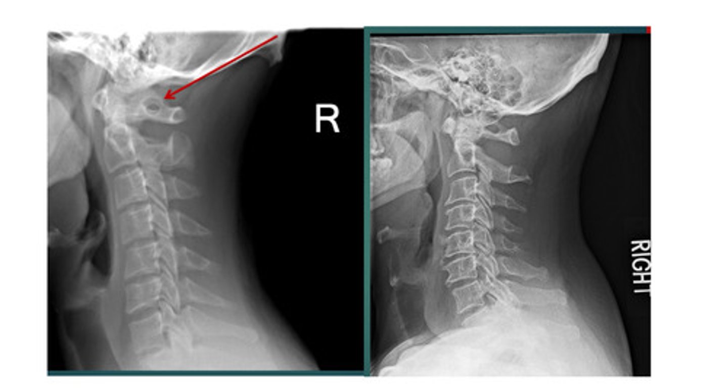 <p>What are we looking at here?</p>