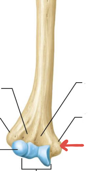 <p>what is this part of the humerus?</p>