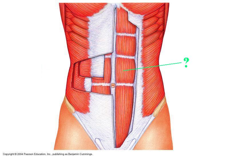<p><span>Identify the indicated muscle</span></p>