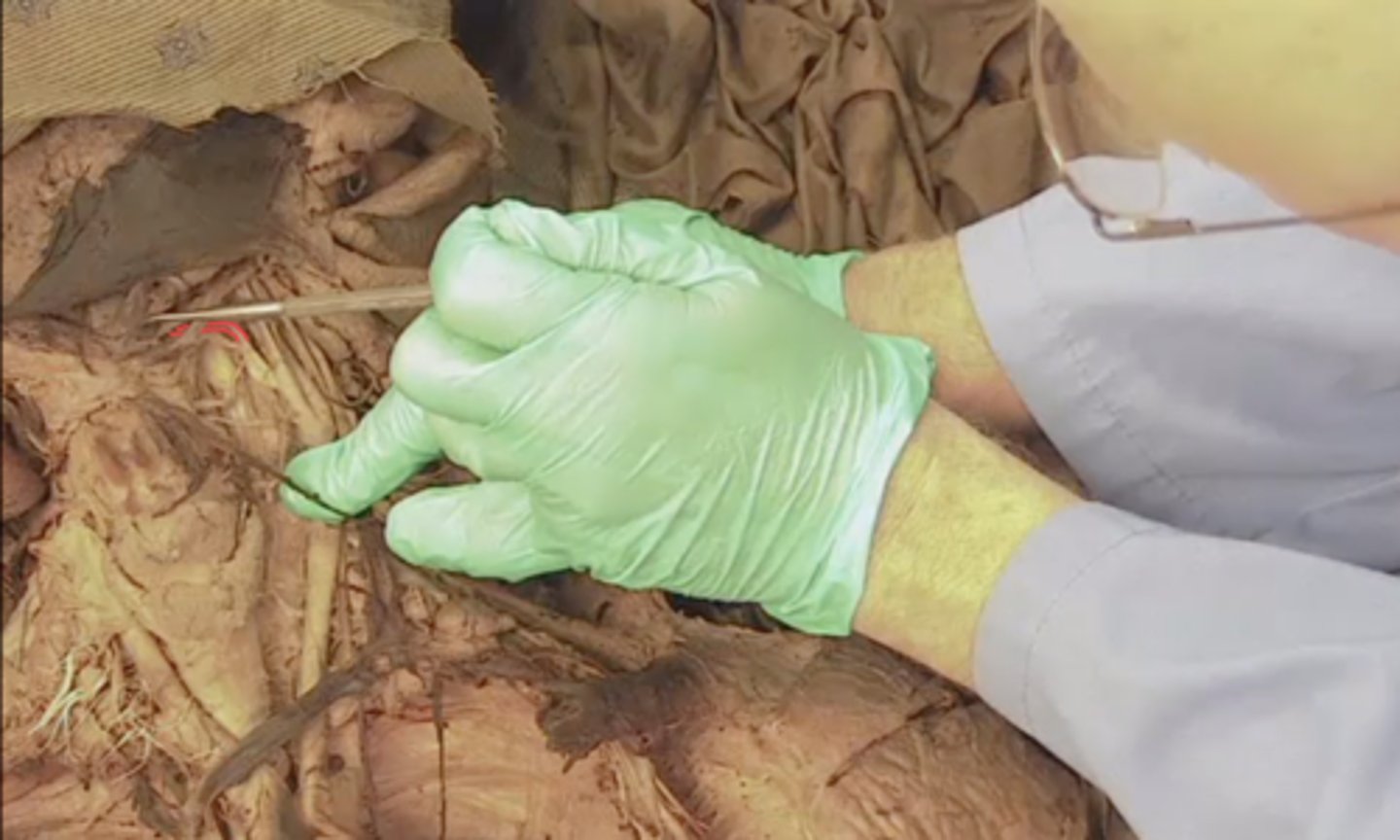 <p>identify this structure</p>