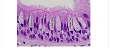- Single layer of narrow cells with varying heights (some ciliated)
- protection; ciliated form secretes mucin, moves mucus
FOUND- respiratory tract lining