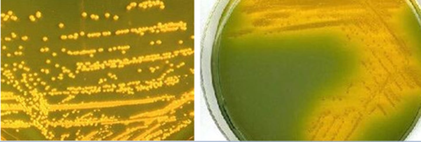 <p>GNB, O1 and O139 serotypes are toxgenic, susceptible O129 10ug disk</p>