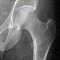 <p>Which way is the leg rotated in this image? </p>