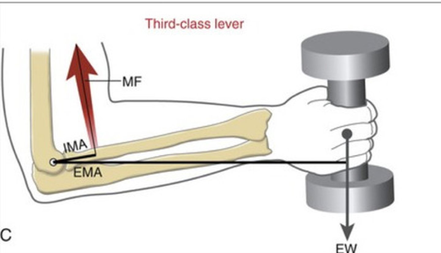<p>Axis of rotation located at one end of a bone and the external force always has greater leverage than the muscle (internal force)</p><p>- Most common lever in the musculoskeletal system bc most muscles attach close to the joint</p><p>(Flexing the elbow - internal moment arm attaching to bicep is short, has to overcome weight of arm and dumbbell)</p>