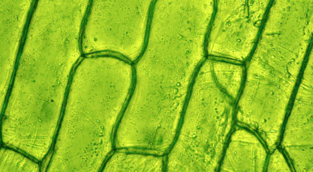 What is this a Microscopic image of? (Plant/Animal Cell)
