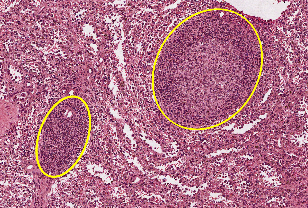 <p>histology, purple dots in the circled areas, cells</p>