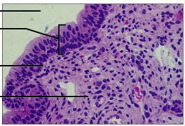 DESCRIPTION: several cells; basal cells are cuboidal; superficial cells are elongated
FUNCTION: protection; secretion
LOCATION: rare in the body; small amounts in male urethra and in large ducts of some glands