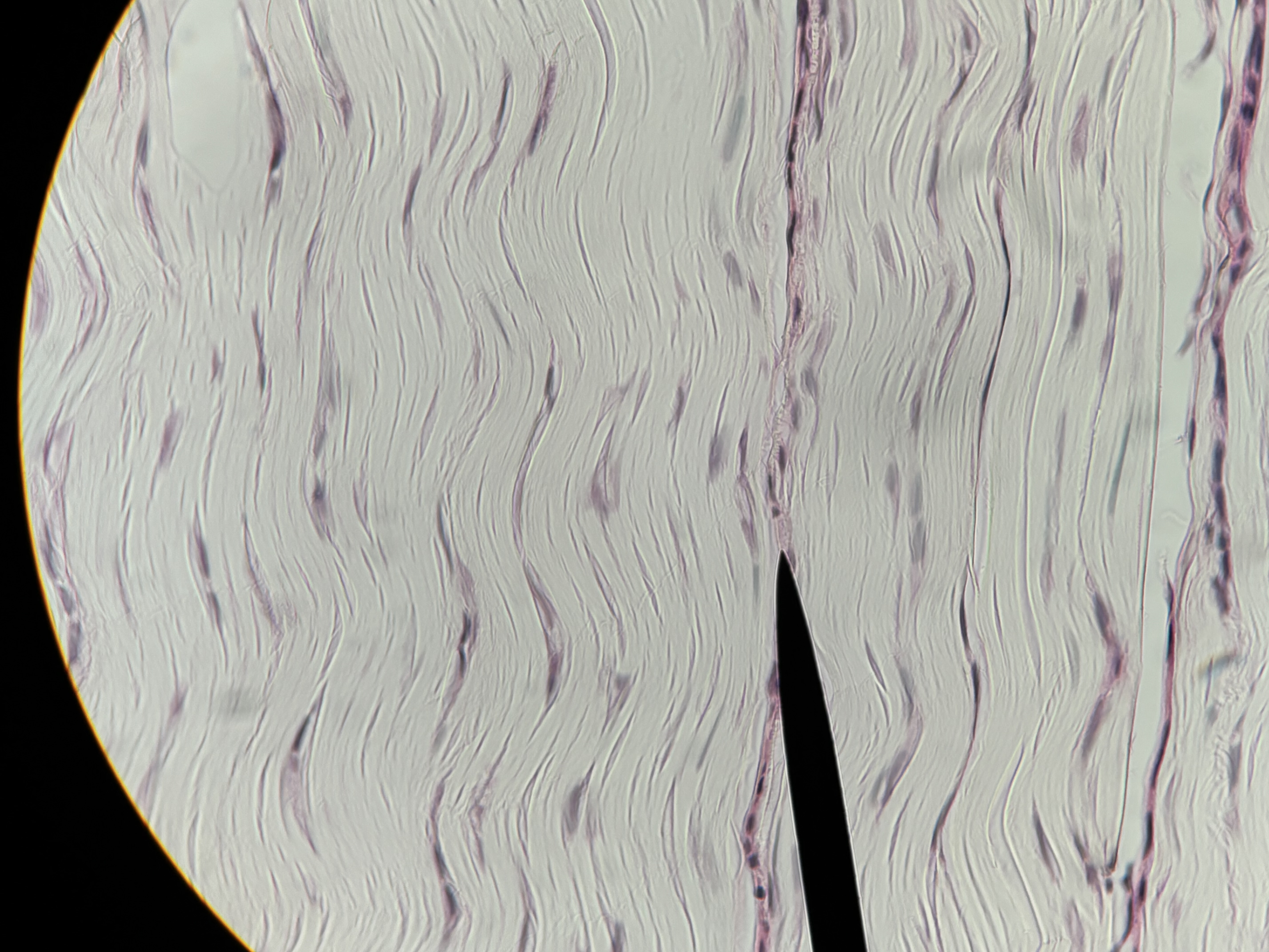 <p><span>Dense regular CT</span></p>
