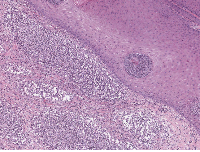 <p>what should you look at first when determining cell injury?</p>