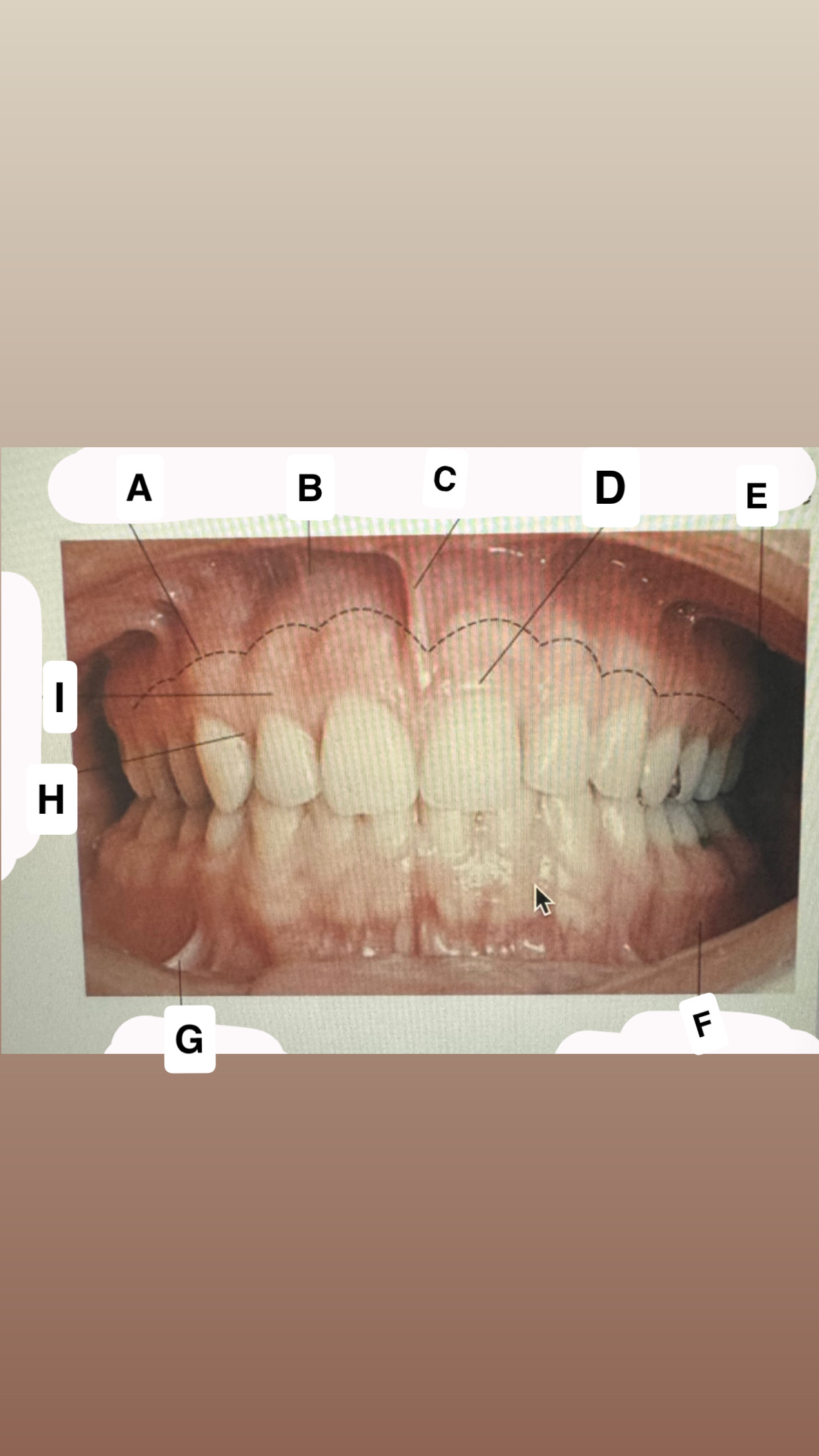 <p>Identify H</p>