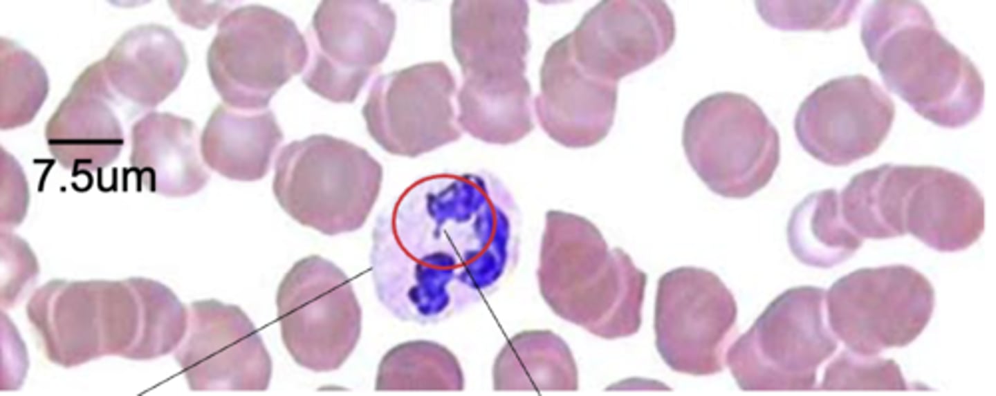 <p>What cell is this? What structure are the right arrow and circle highlighting?</p>