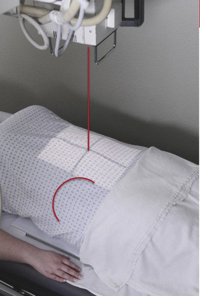 <ul><li><p>Supine on cart </p></li><li><p>Arms abducted from body</p></li></ul><p></p>