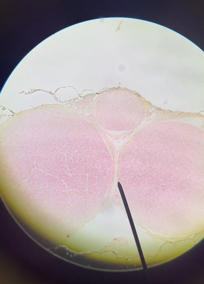 <p>1. What are you looking at in this slide?</p><p>2. What connective tissue layer is the pointer on?</p><p>3. What are the large round structures called?</p>