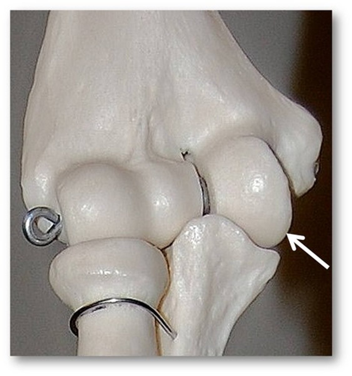 <p>Name the structure of the ulna</p>