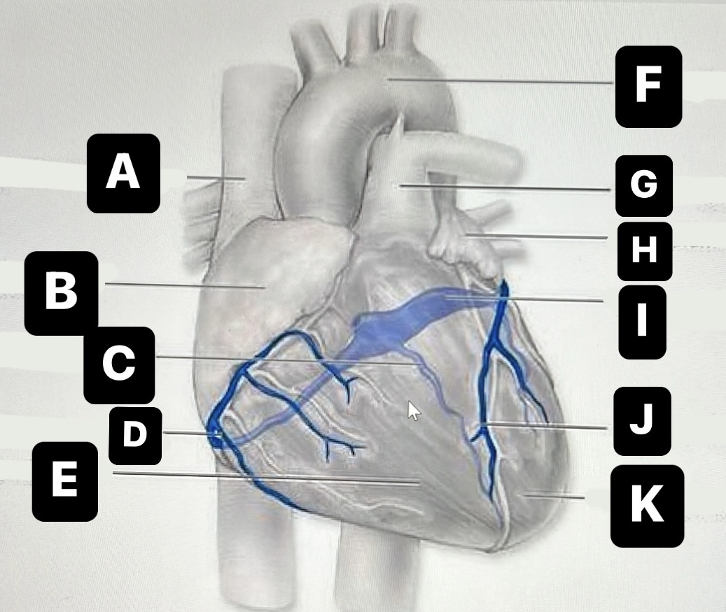 <p>Pulmonary trunk</p>