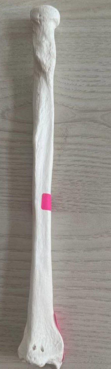 <p>Identify the bone and classify according to position and shape</p>