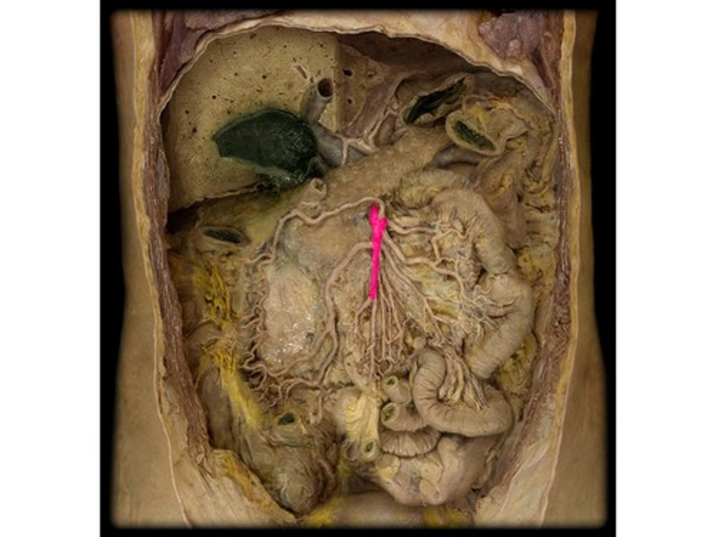 knowt flashcard image