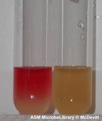 <p>What <strong>biochemical test</strong> is involved in this set-up?</p>
