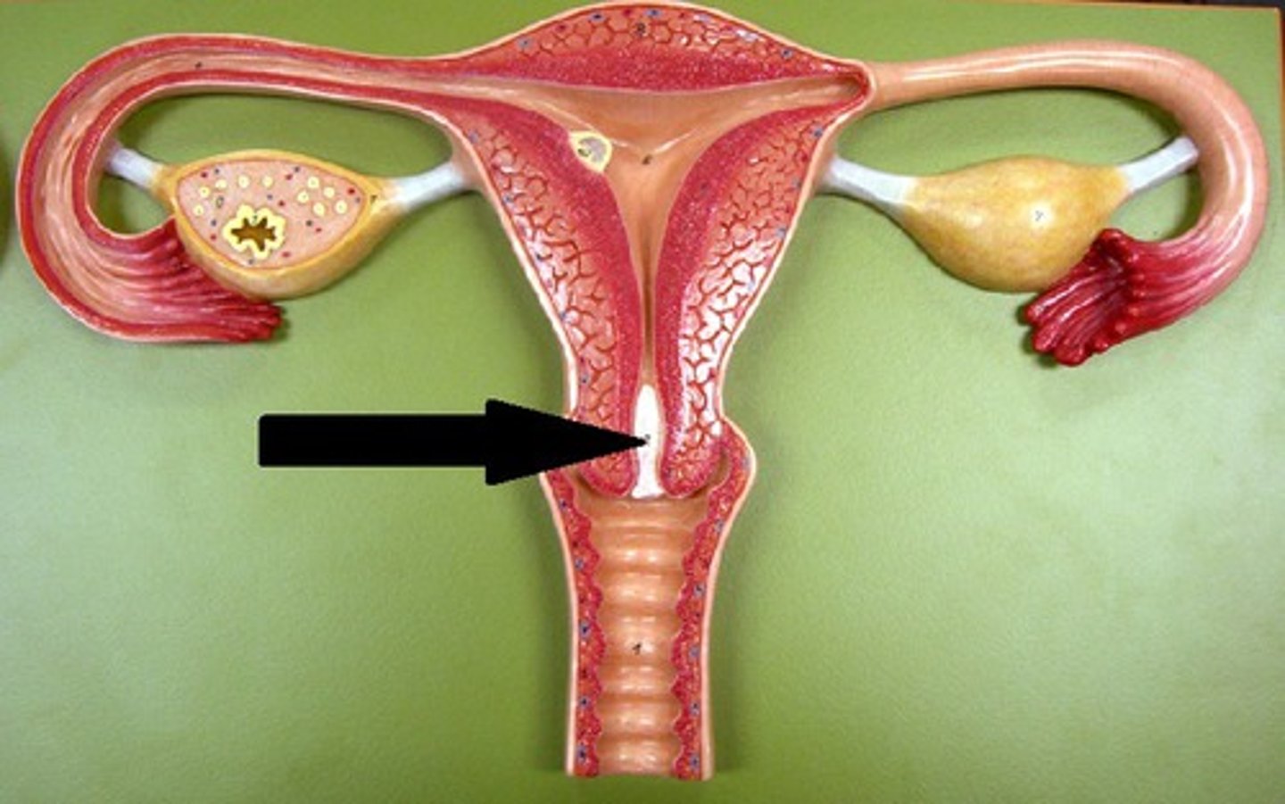 <p>forms in area of cervix to prevent bacteria from entering</p>