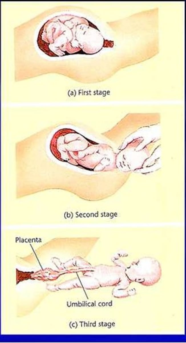 <p>Four phases of childbirth: dilation, expulsion, placenta delivery, recovery.</p>