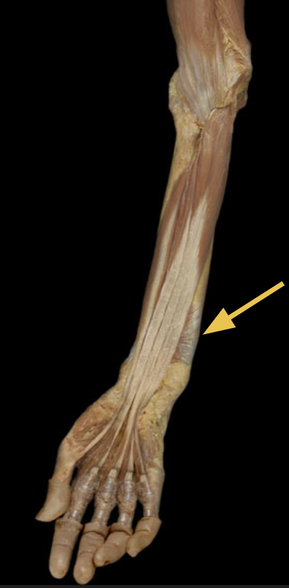 <p>identify + state origin, insertion, action, innervation of marked structure</p>