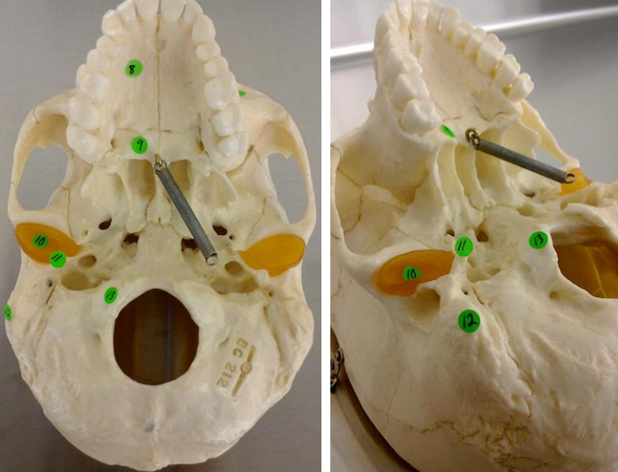 <p>#10 - (inferior skull)</p>