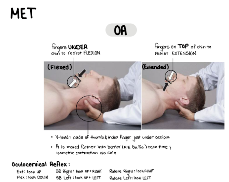 <ul><li><p>V Hold - patient laying down</p></li><li><p>The diagnosis is OPPOSITE ALWAYS, so go opposite that.</p></li><li><p>If the patient is flexed, put your hand below chin to resist.</p></li><li><p>Encourage patient to close eyes, then open eyes, and look down for three seconds.</p></li><li><p>Then rest for 2 seconds.</p></li><li><p>Go further into barrier each time.</p></li></ul><p></p>