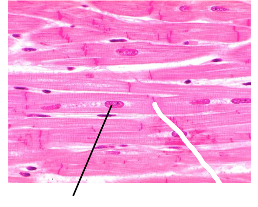 <p>What part of the muscle tissue is this?</p>