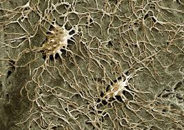 <p>Mature bone cell residing in a lacuna; maintains bone matrix.</p>