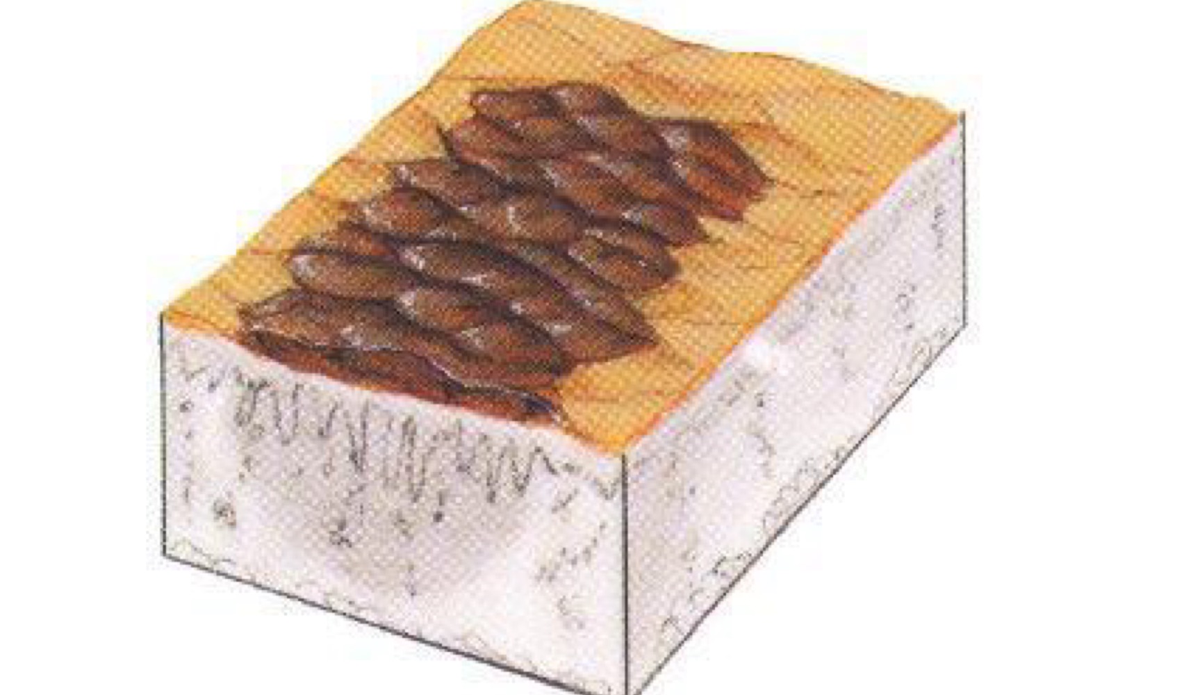 <p>what type of skin lesion is this? </p>