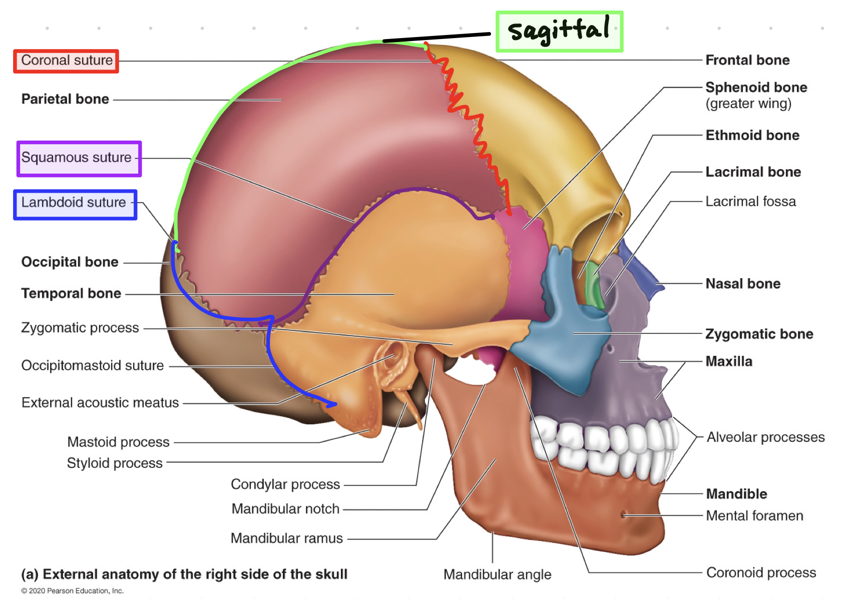 <p><mark data-color="yellow"><u>coronal, squamous, sagittal, lambdoid</u></mark></p>