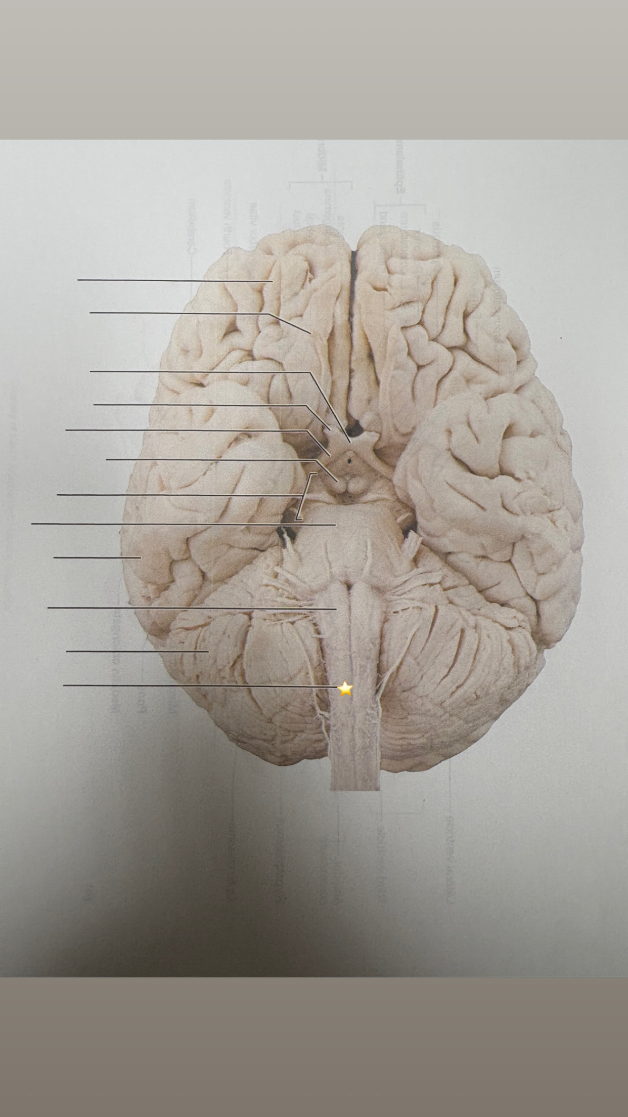 <p>name the starred structure</p>