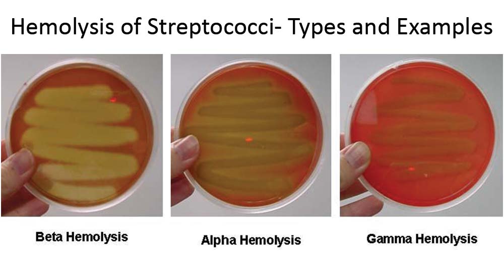 <ul><li><p>Alpha hemolysis: green coloring under bacteria colonies; partial lysis of cells</p></li><li><p>Beta hemolysis: Clearing around the colonies; complete lysis of cells</p></li><li><p>Gamma Hemolysis: Growth on plate without any lytic action (non-hemolytic) Temp 37*C</p></li></ul>