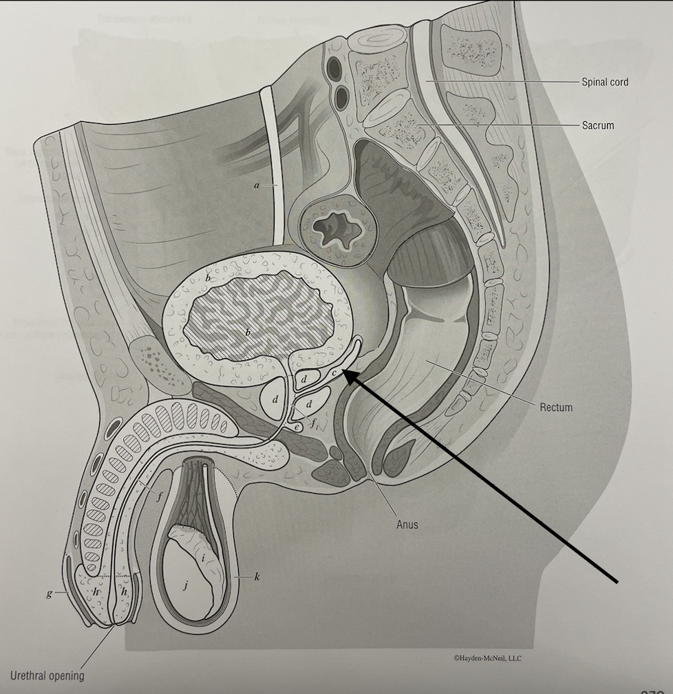 <p>what structure is this</p>