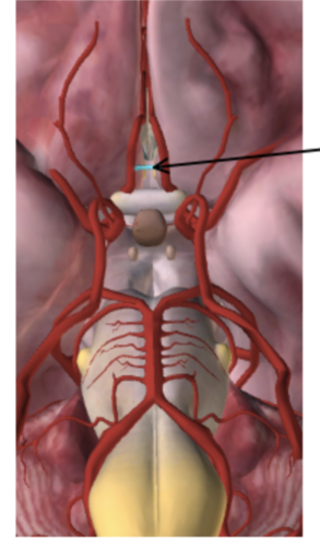 <p><span>What is the name of the artery in the figure below (in blue also indicated by the arrow)?</span></p><p><br></p>