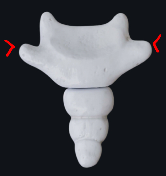 <p>What are the red arrows pointing to?</p>