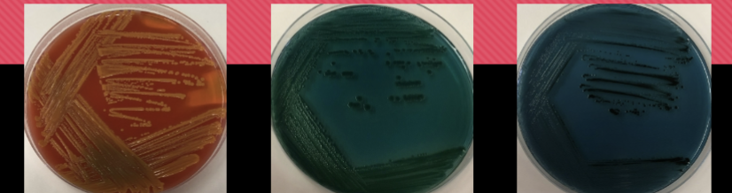 <p>HEA agar only allows growth for </p>