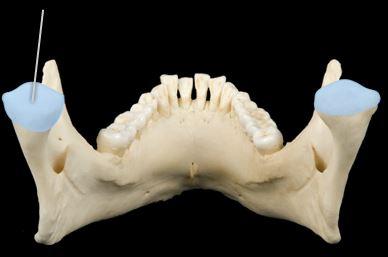 <p><span>Name the section in blue? (posterior view)</span></p>