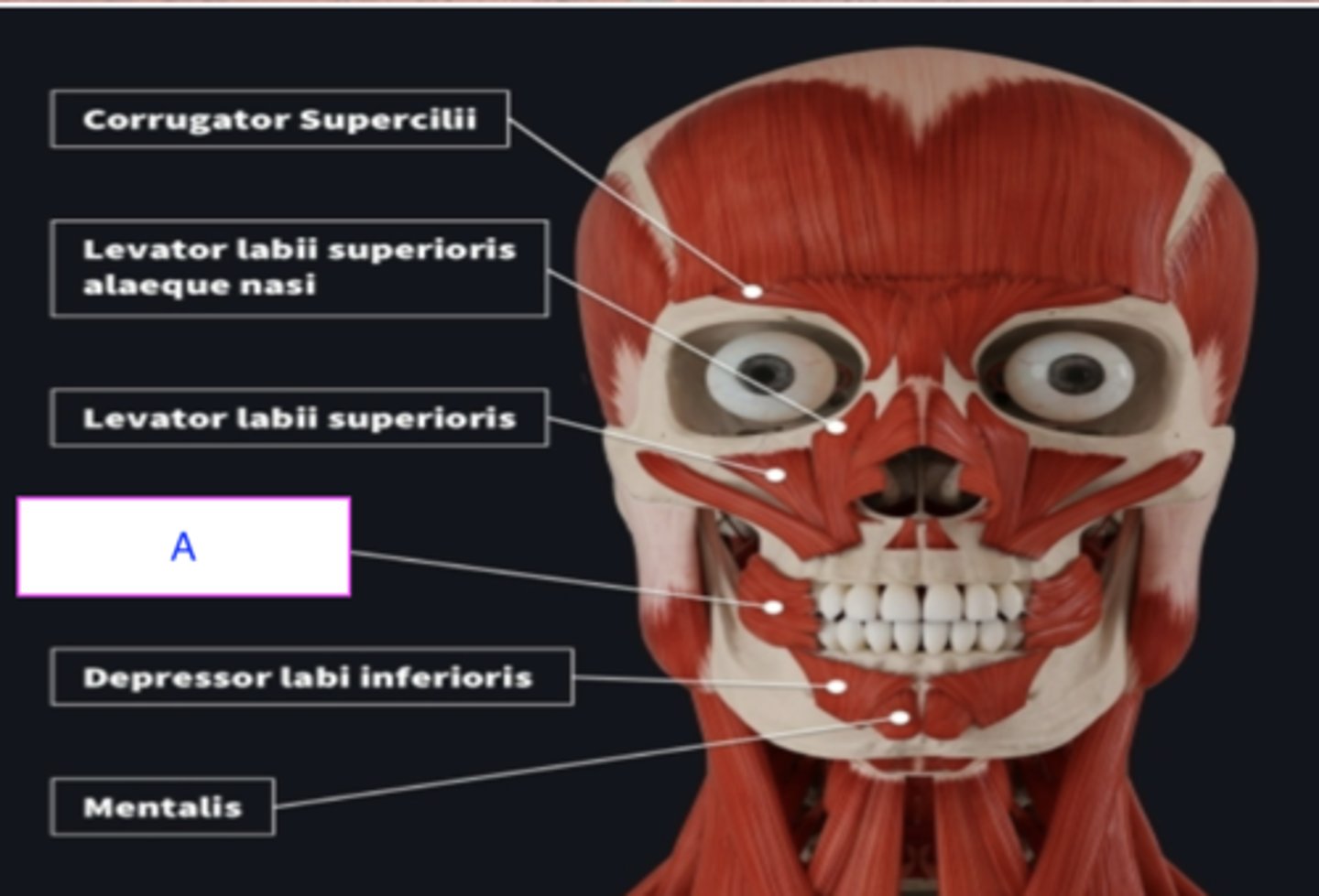 <p>ID muscle</p><p>- compresses cheek</p>