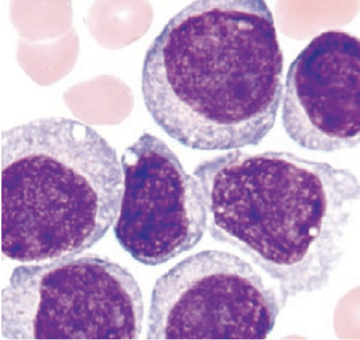 <p>what cell predominates&nbsp;in M5a?</p>