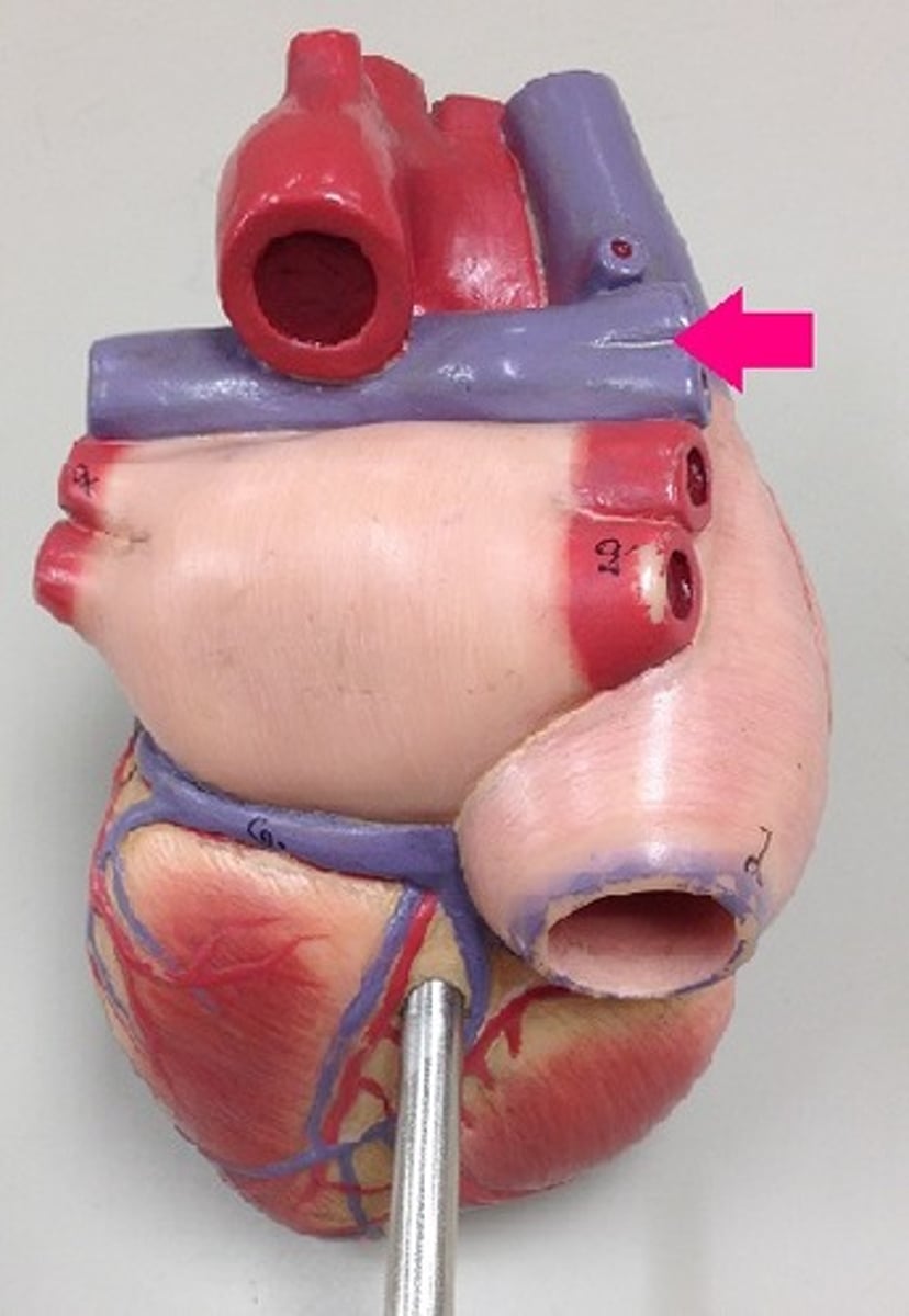 <p>Identify the vessel. Be specific.</p>