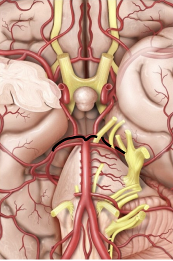<p>The terminal branch of the basilar artery that supplies the occipital lobes.</p>